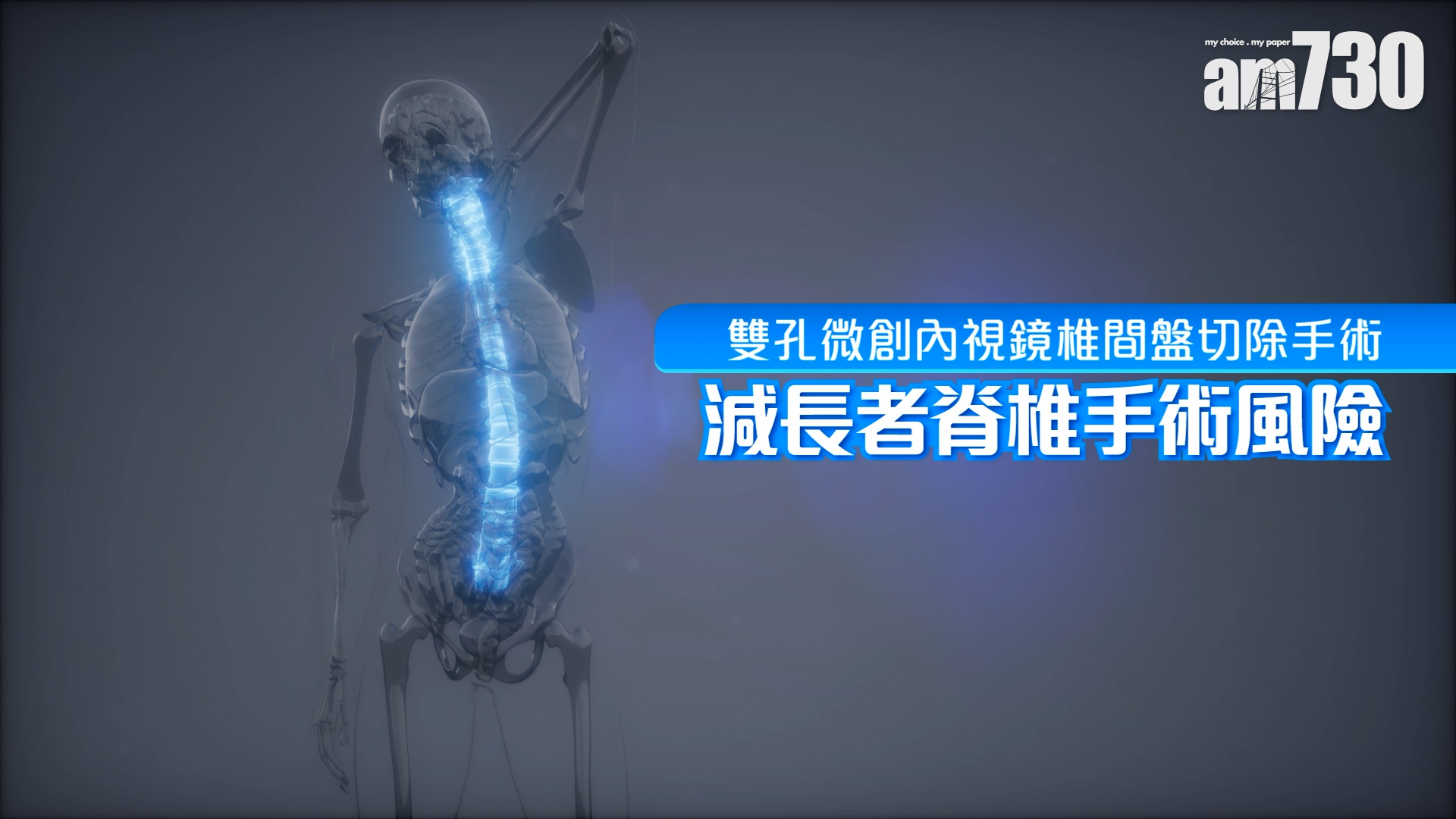 雙孔微創內視鏡椎間盤切除手術