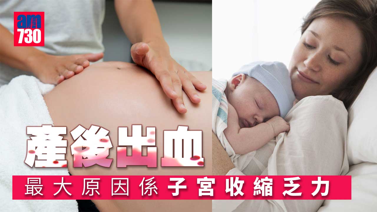 產後出血 子宮收縮乏力係最大原因