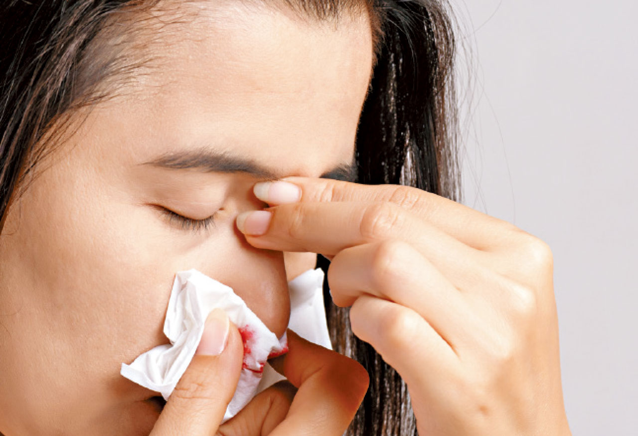 掌握正確的止鼻血方法