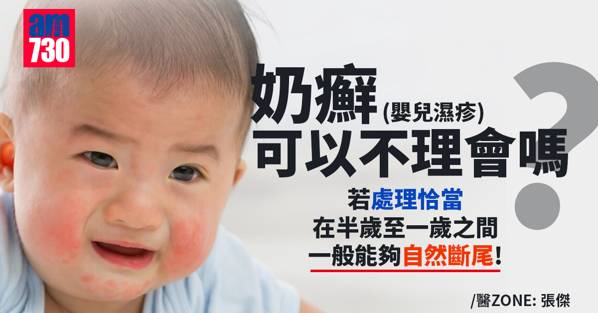 奶癬可以不理會嗎？