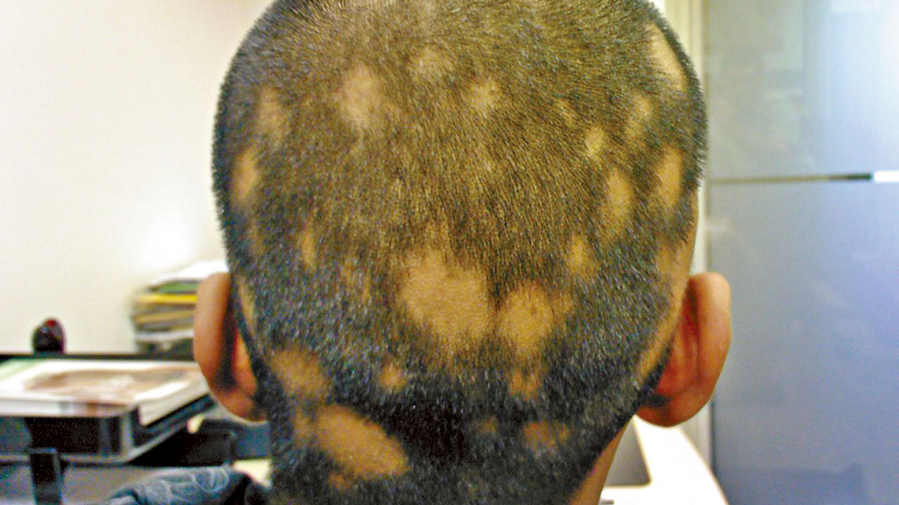 唔想鬼剃頭 最緊要開心