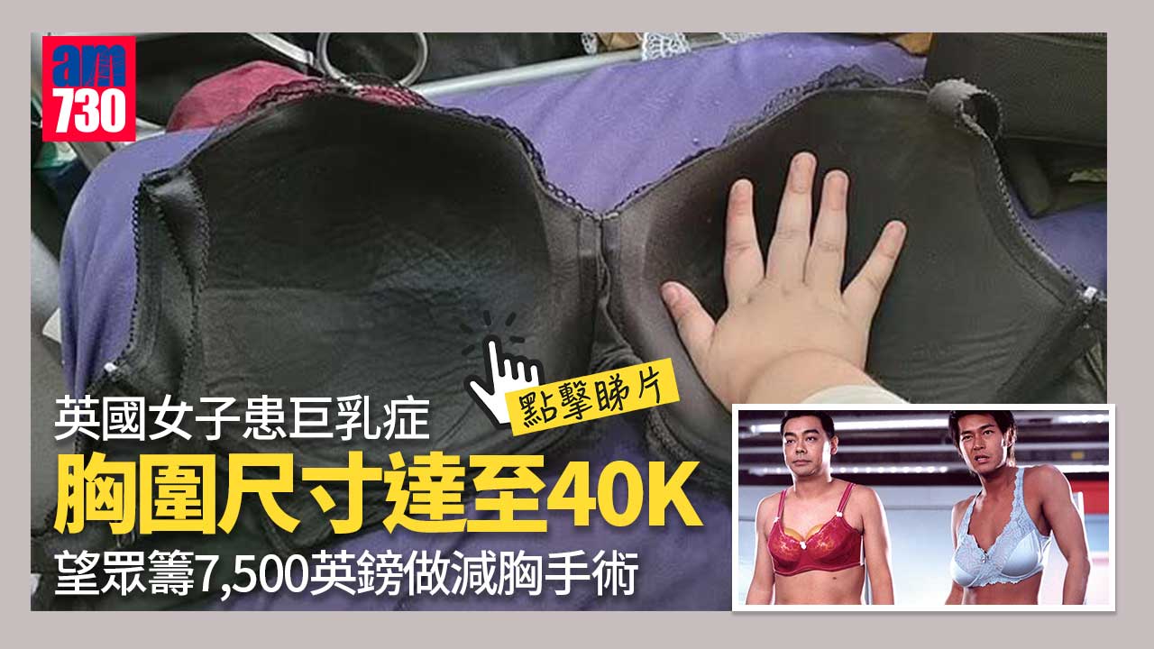 患巨乳症-英女胸圍尺寸40K