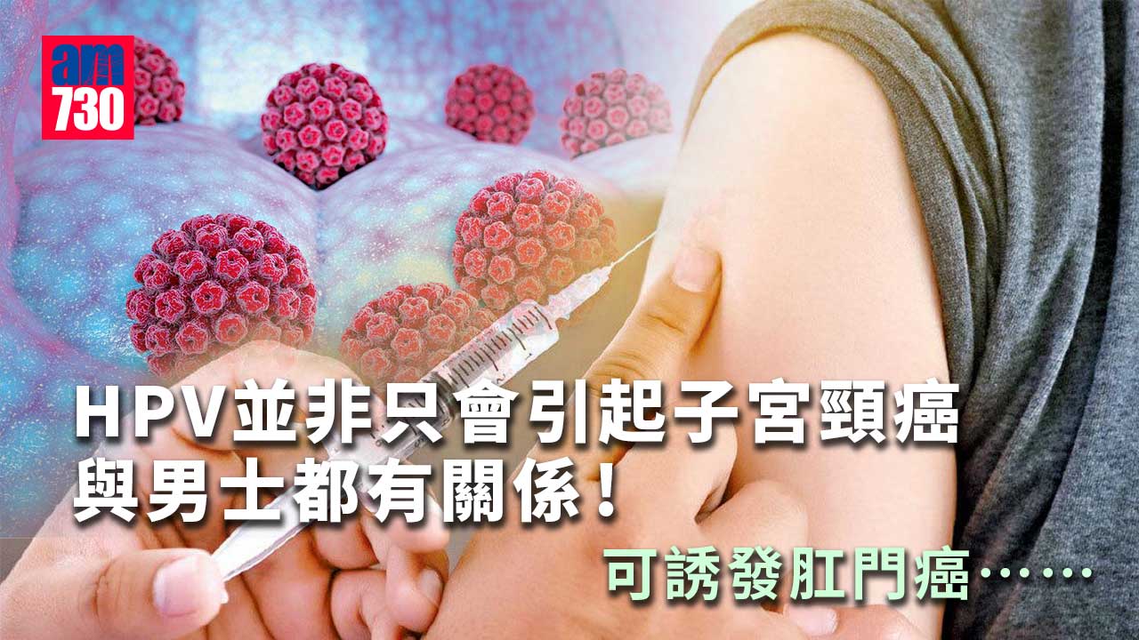 感染HPV 可誘發肛門癌