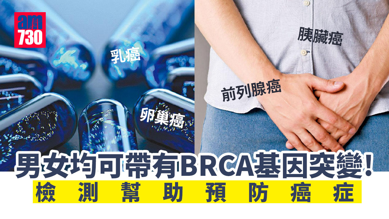 BRCA基因檢測 幫助預防癌症