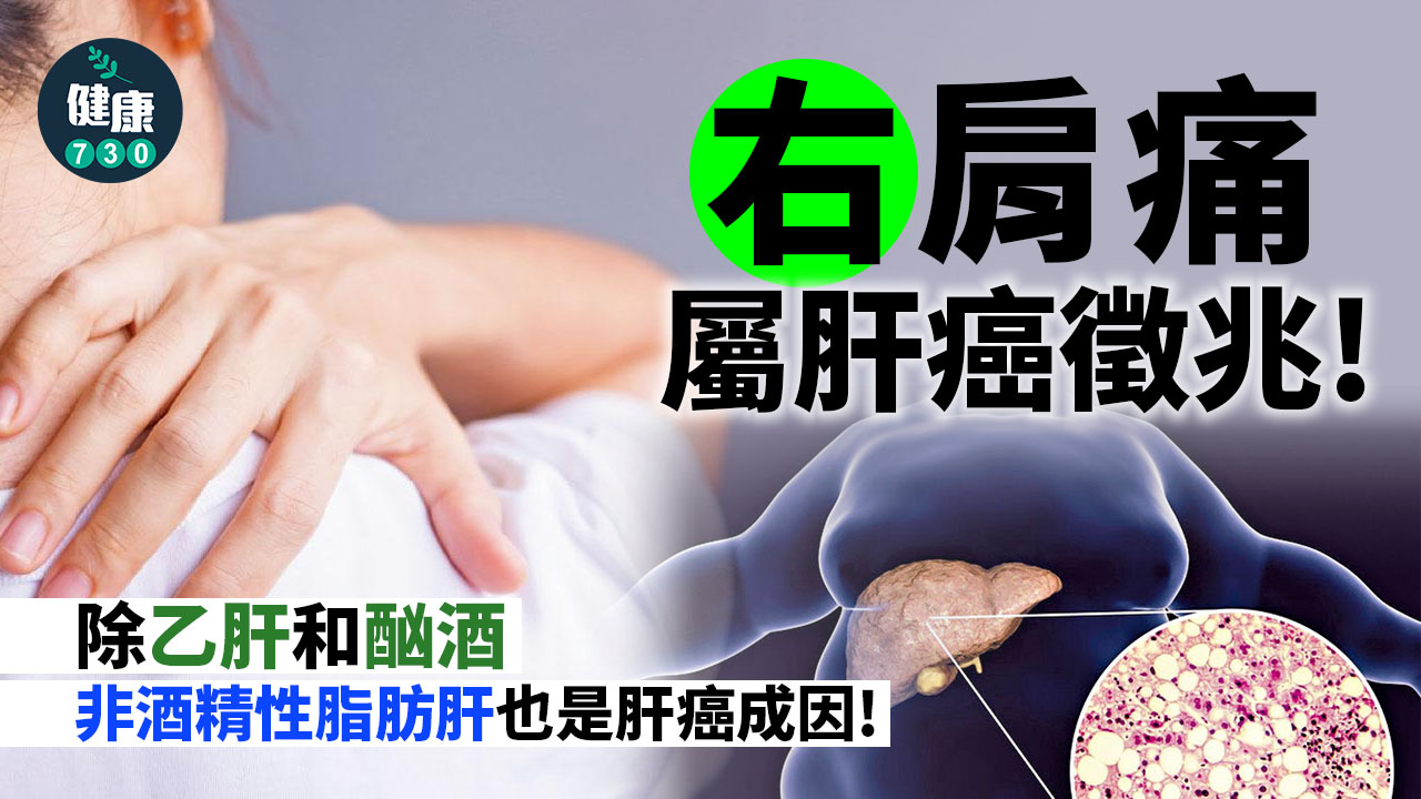 右肩痛屬肝癌徵兆