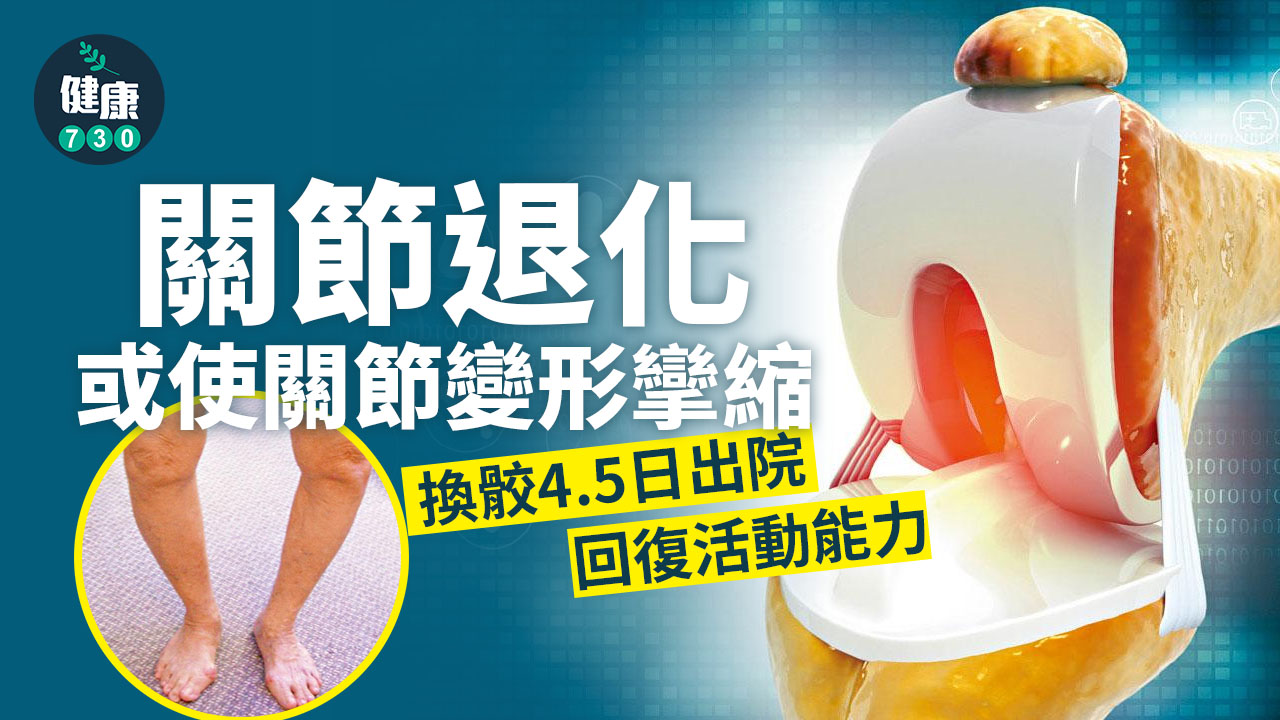 換骹4.5日出院 回復活動能力