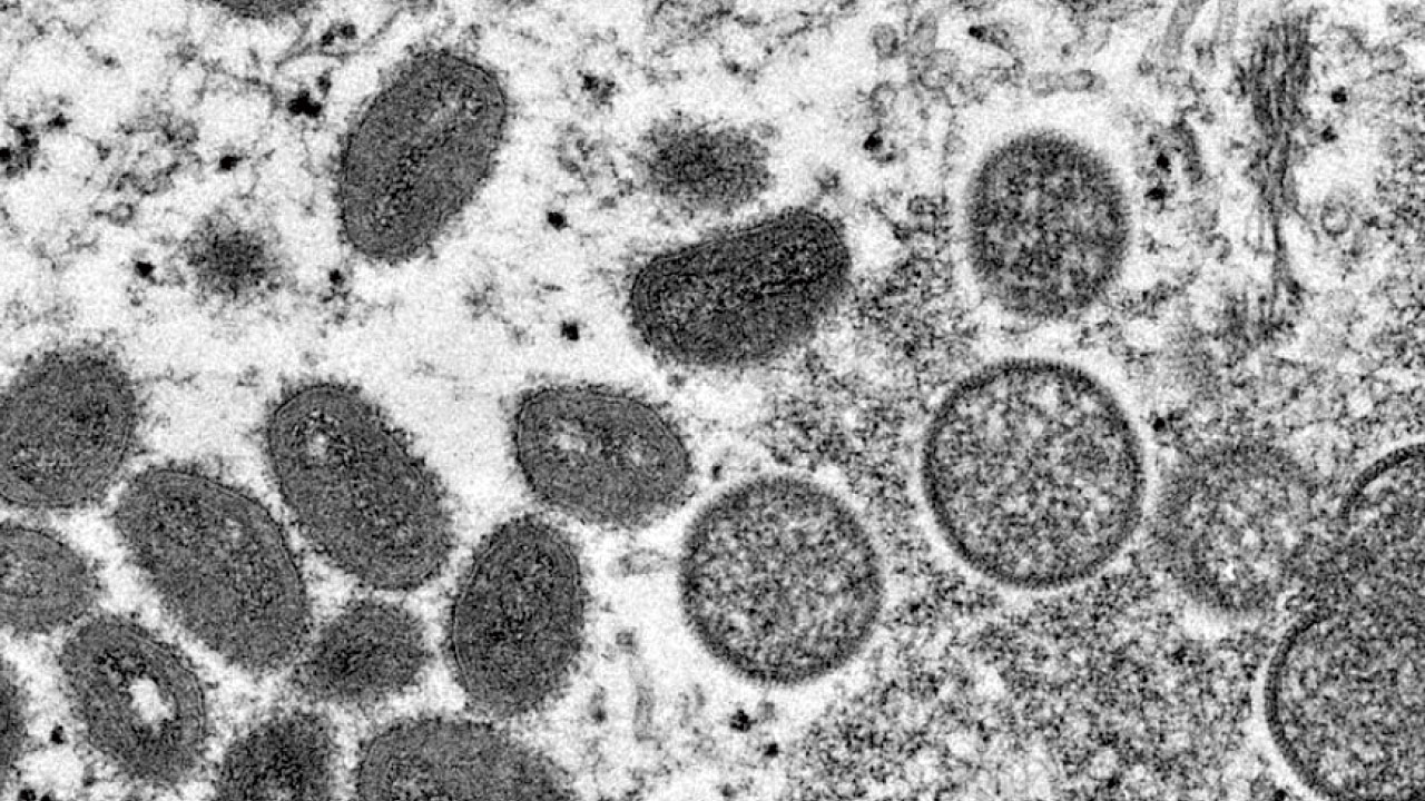 CDC建議戴口罩後突刪  專家不排除猴痘空氣傳播