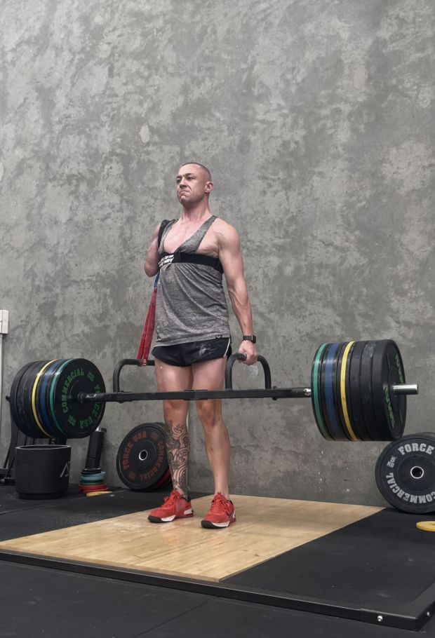 澳男舉50KG啞鈴撕斷手臂  駁回後染食肉菌須截肢保命