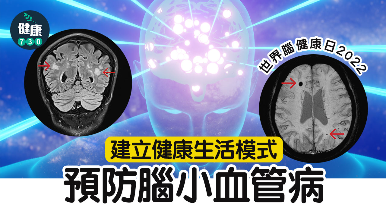 世界腦健康日2022 預防腦小血管病