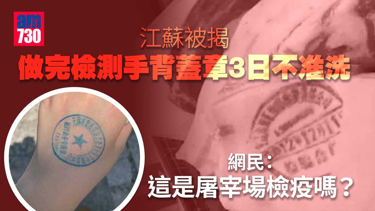 疫情｜做完檢測手背蓋章3日不准洗 網民：屠宰場檢疫嗎？