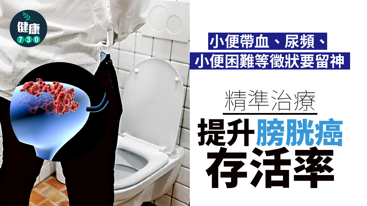 精準治療 提升膀胱癌存活率