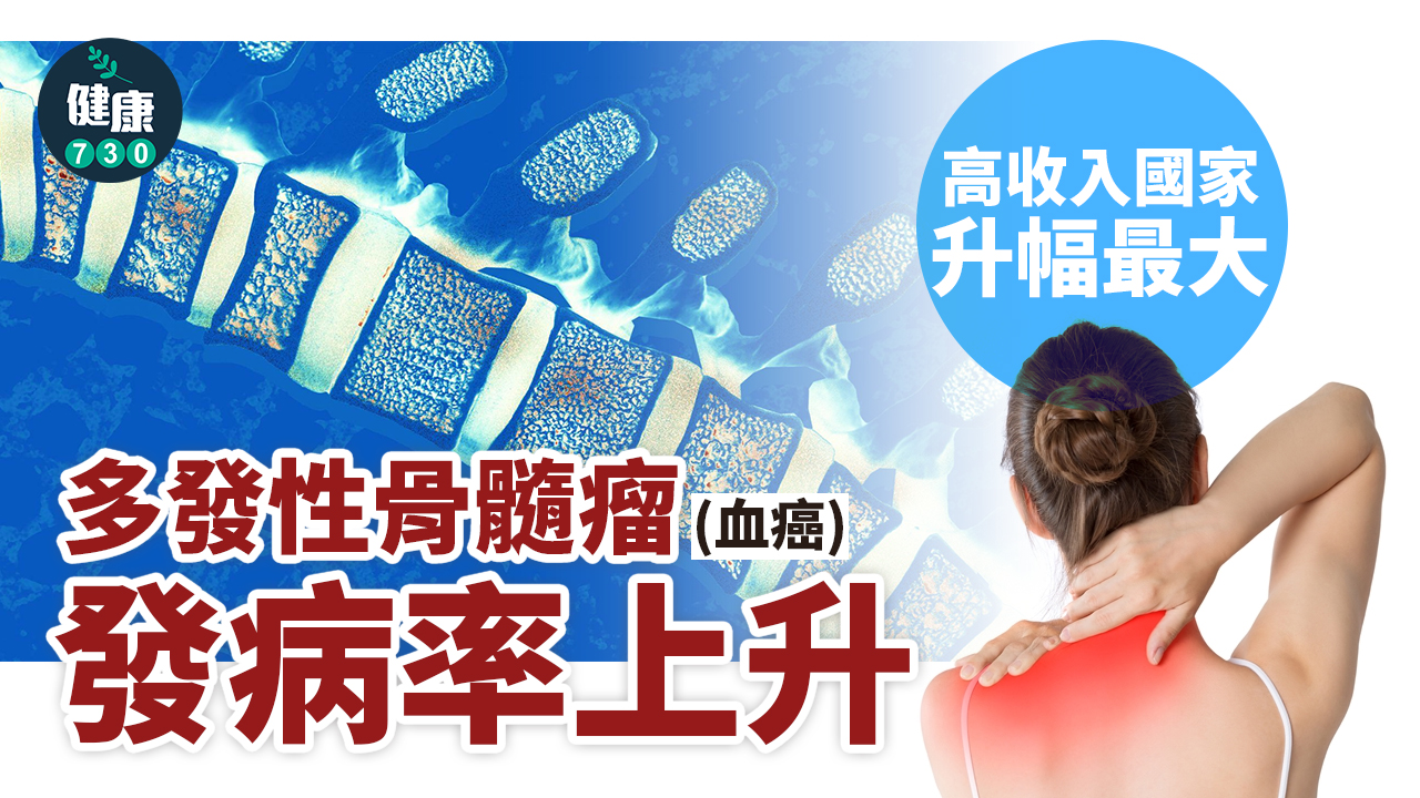 血癌｜多發性骨髓瘤發病率上升 高收入國家升幅最大