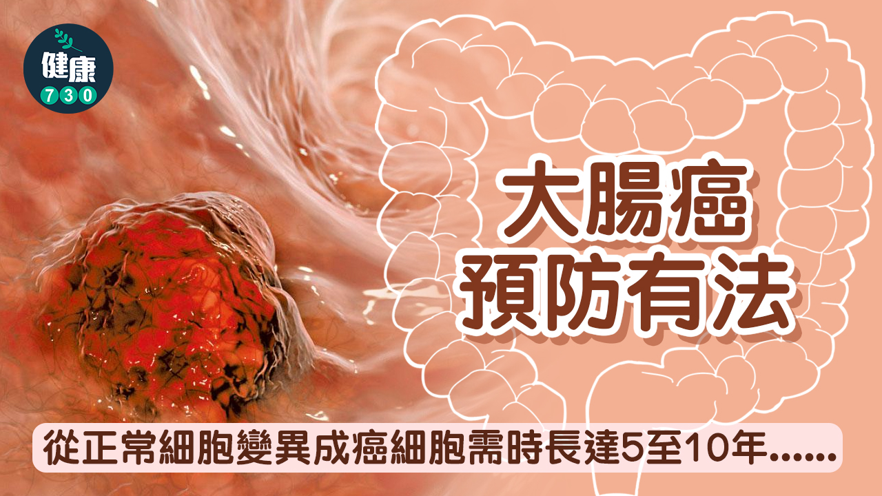 大腸癌 預防有法
