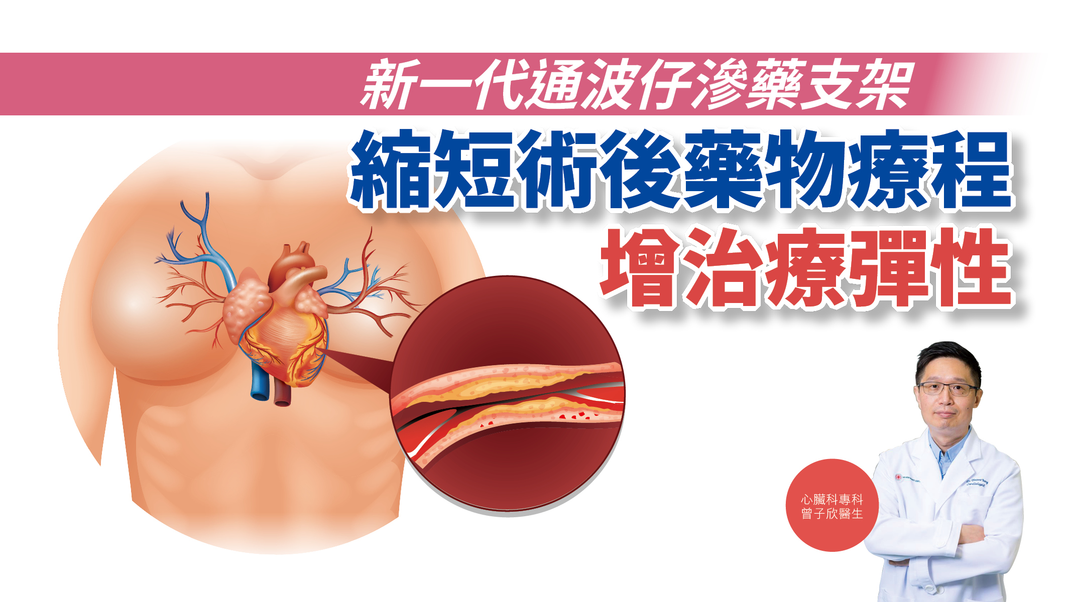新一代通波仔滲藥支架 縮短術後藥物療程 增治療彈性