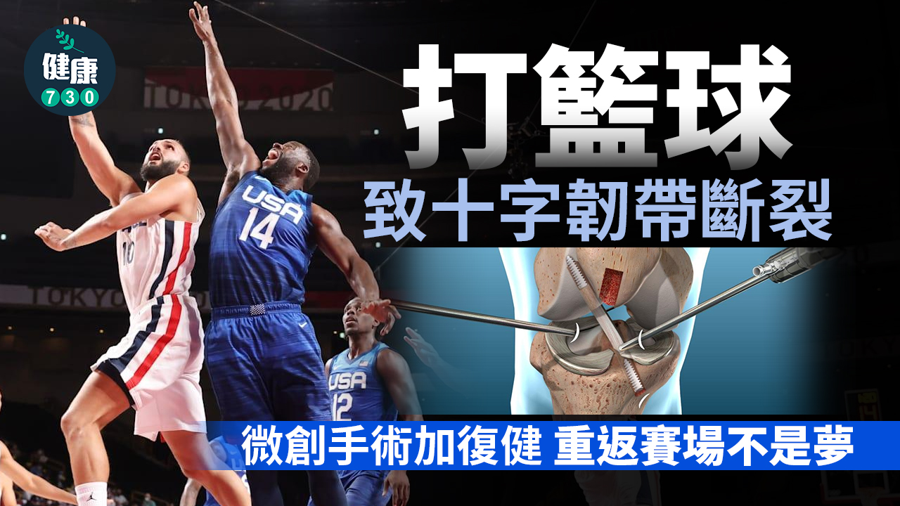 搶籃板致斷十字韌帶 微創重建重返賽場