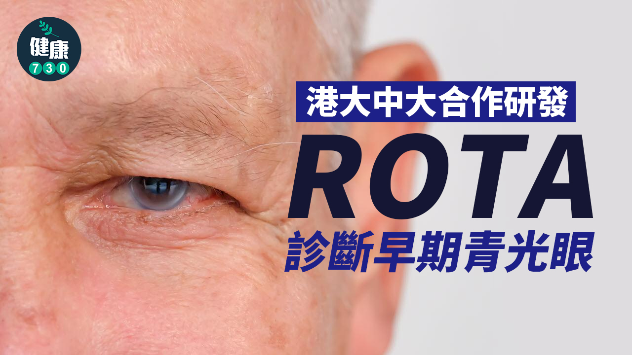 港大中大合作研發 ROTA診斷早期青光眼