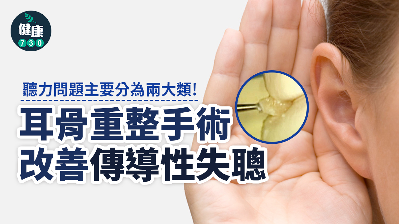 耳骨重整手術 改善傳導性失聰