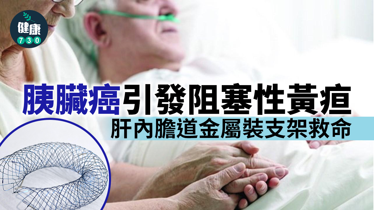 胰臟癌引發阻塞性黃疸 肝內膽道金屬裝支架救命