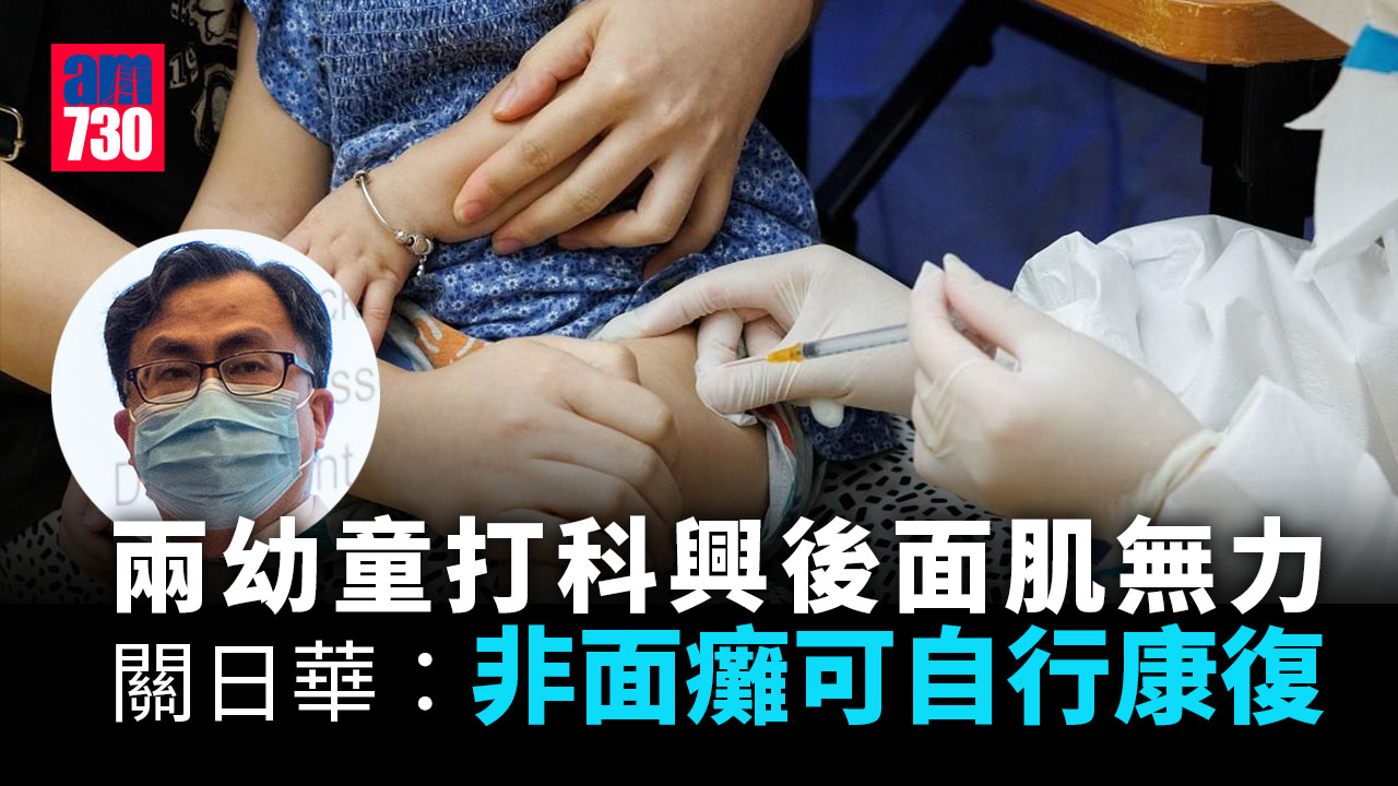 疫苗接種｜兩童打科興後面肌無力　關日華：非面癱可自行康復