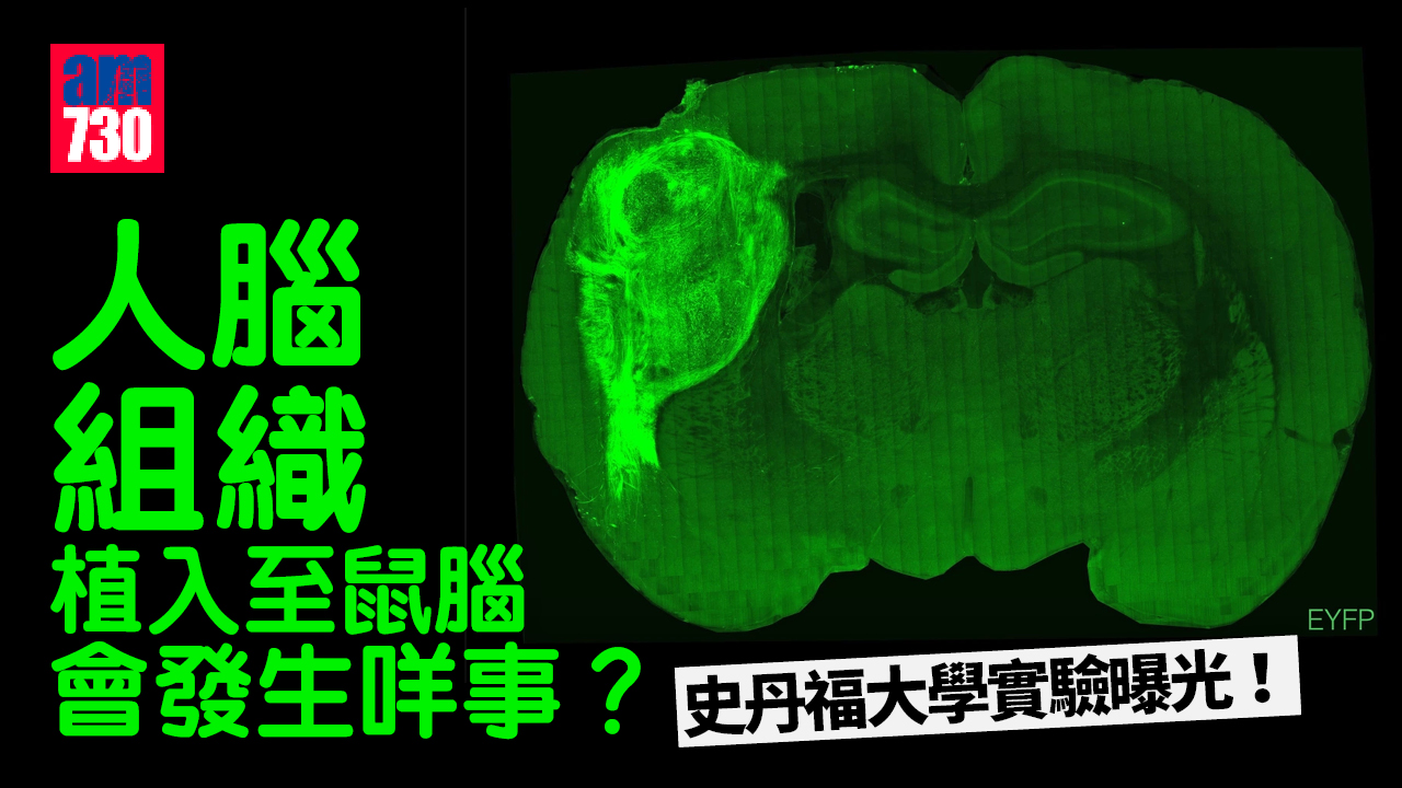 人腦組織植入至鼠腦 會發生咩事？史丹福大學實驗曝光