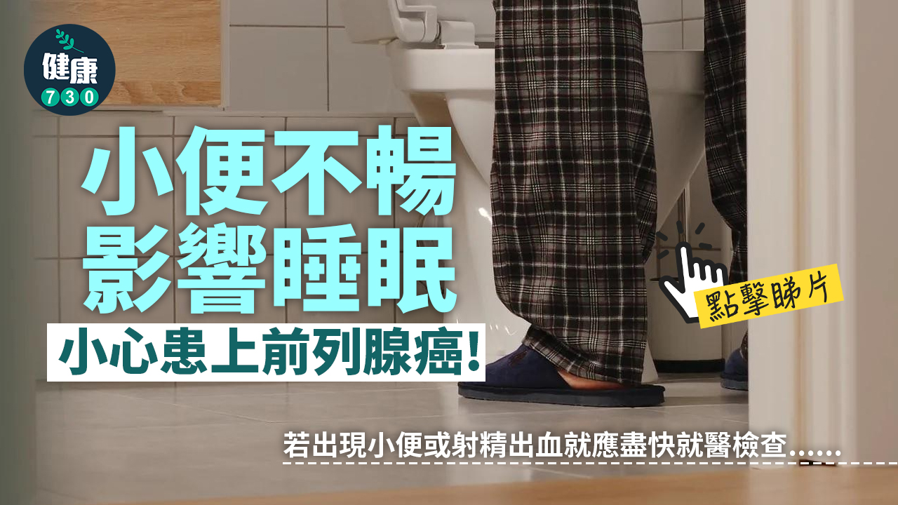 癌症｜小便不暢影響睡眠 小心患上前列腺癌