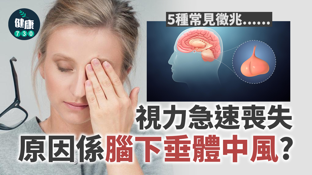 視力急速喪失 原因係腦下垂體中風？