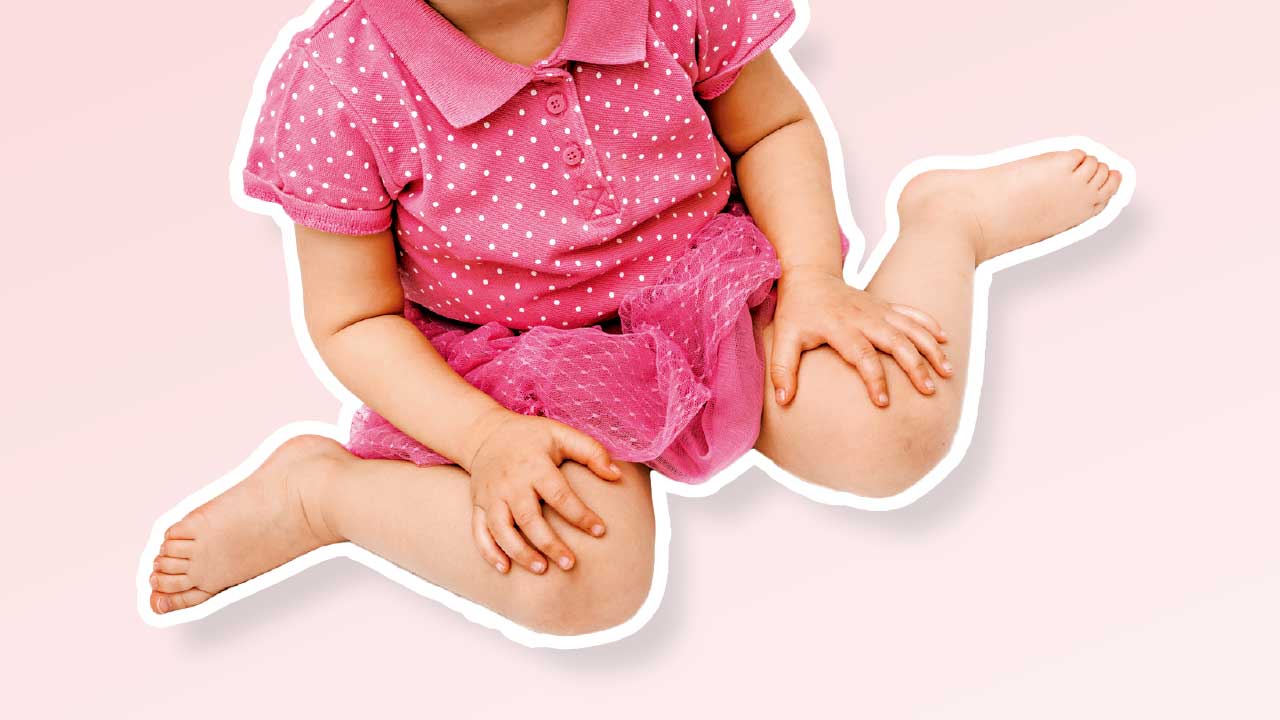 小朋友W腳需要糾正？