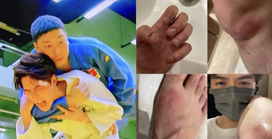 野人老師｜Frankie傷痕纍纍騷戰績  打柔道唔簡單