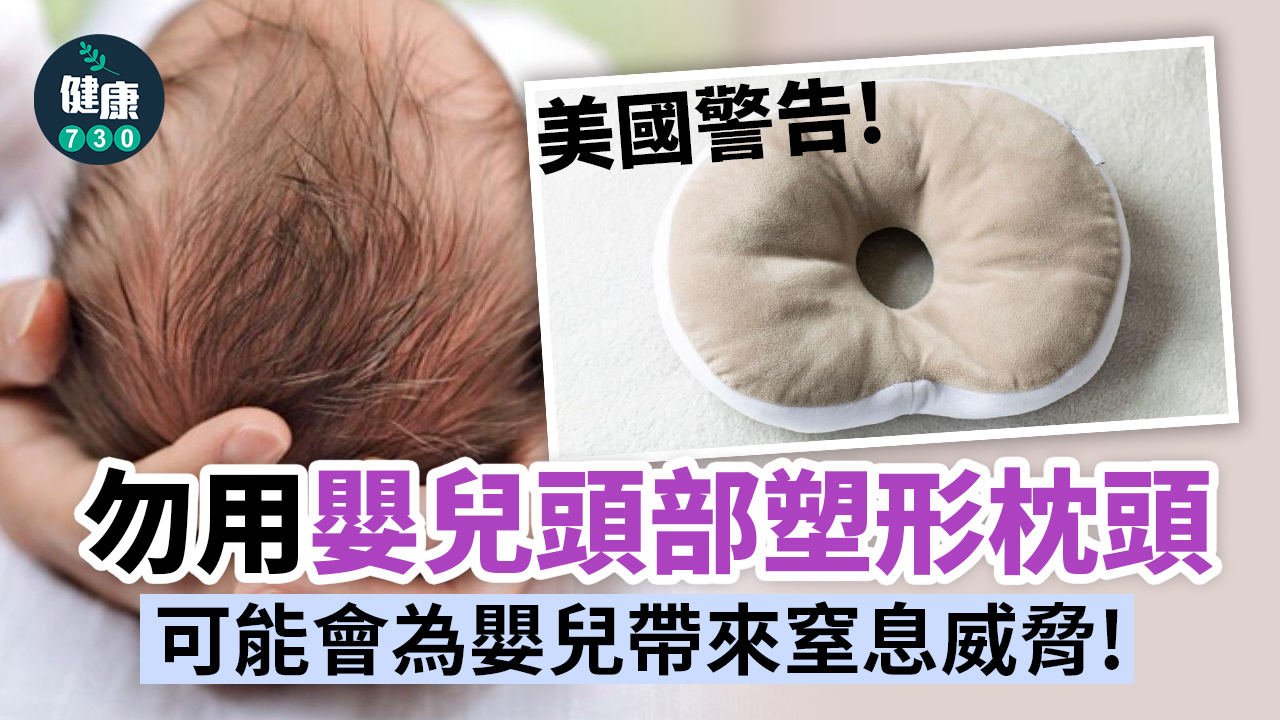 嬰兒｜美國警告 勿用嬰兒頭部塑形枕頭