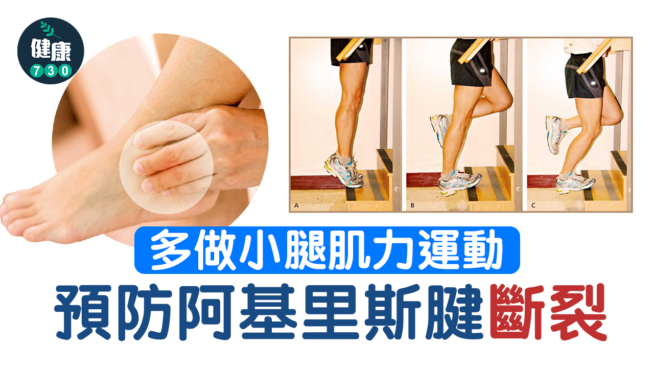 阿基里斯腱斷裂 約半年可康復