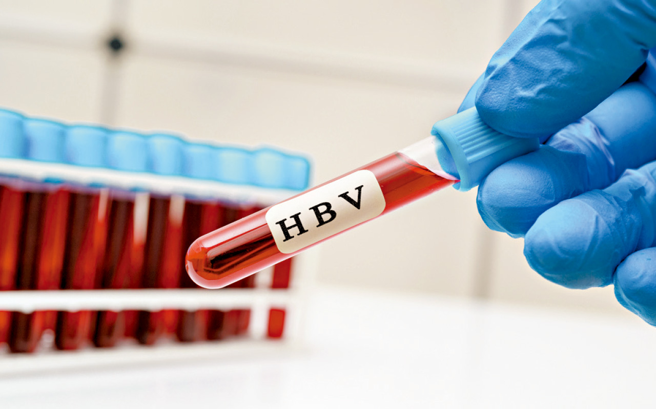 基層醫療中乙型肝炎及慢性乙型肝炎的普遍篩查和管理