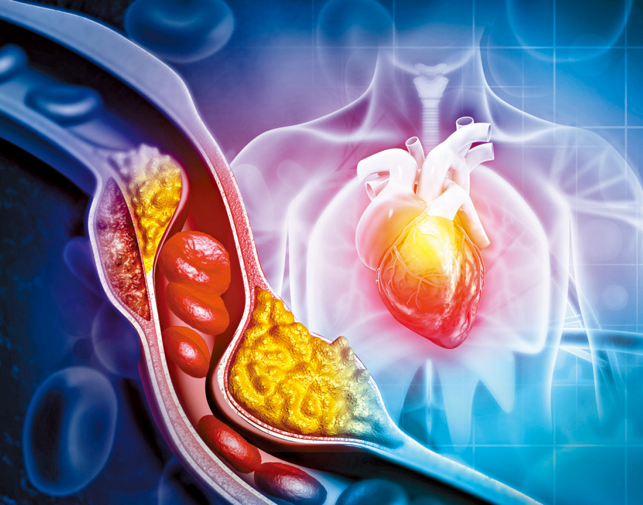 膽固醇藥一食就唔停得？