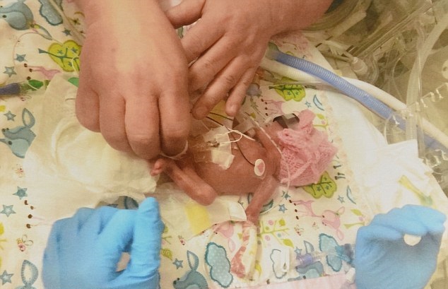 最袖珍大禮物 24周出生奇蹟