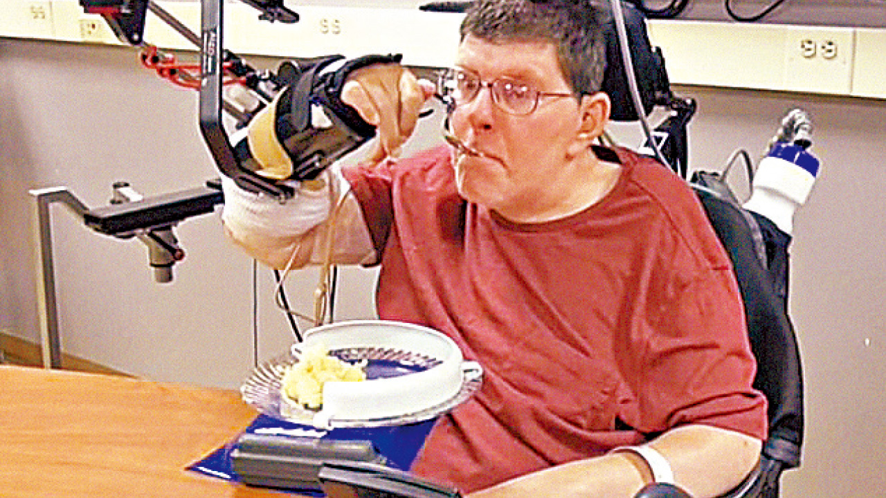 電極刺激手臂肌肉 醫學首例  美癱瘓漢自行進食