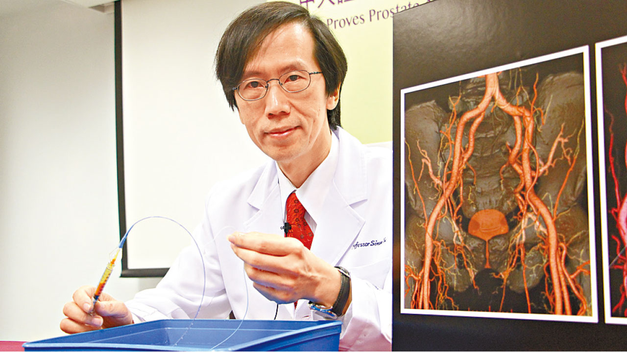 受前列腺增生困擾 栓塞術舒緩膀胱阻塞