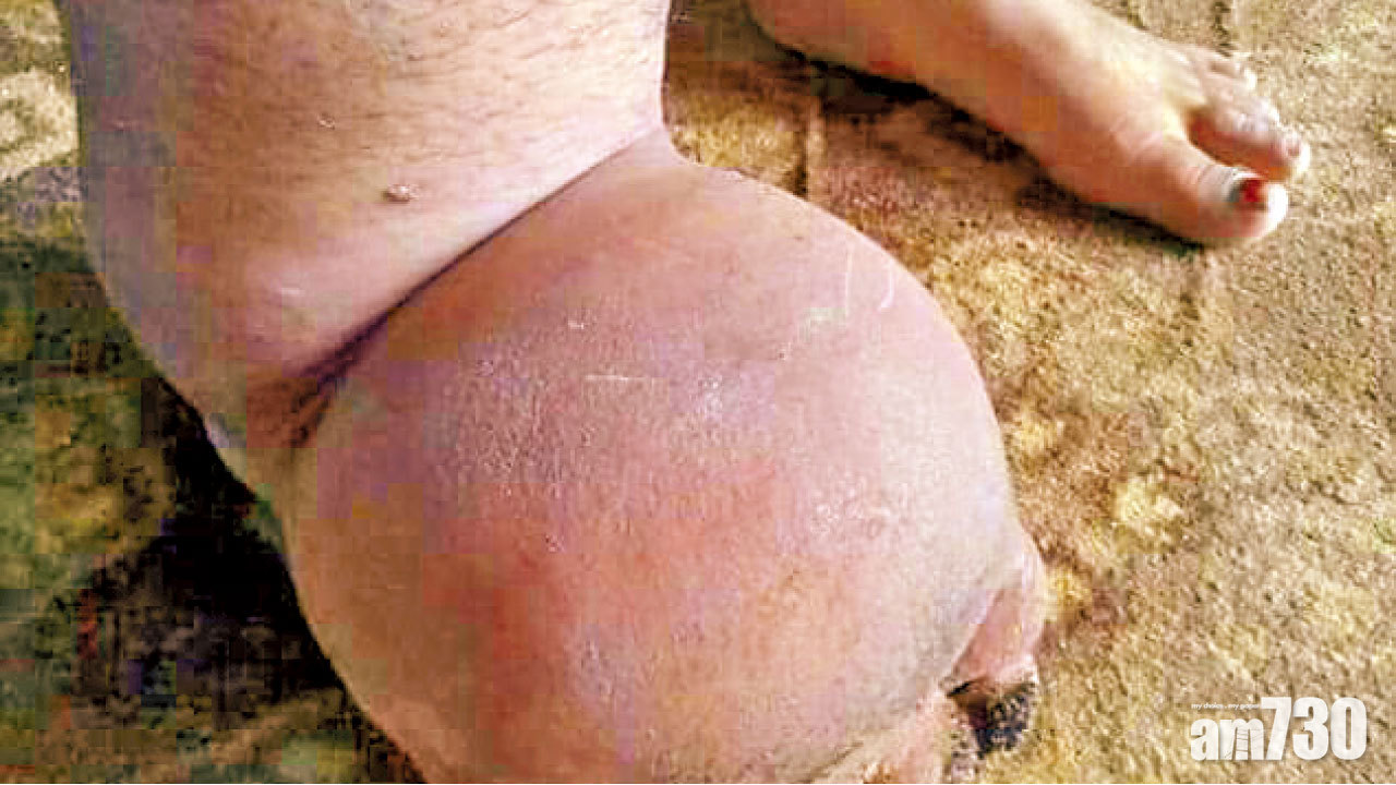 一叮變跛象蹄女