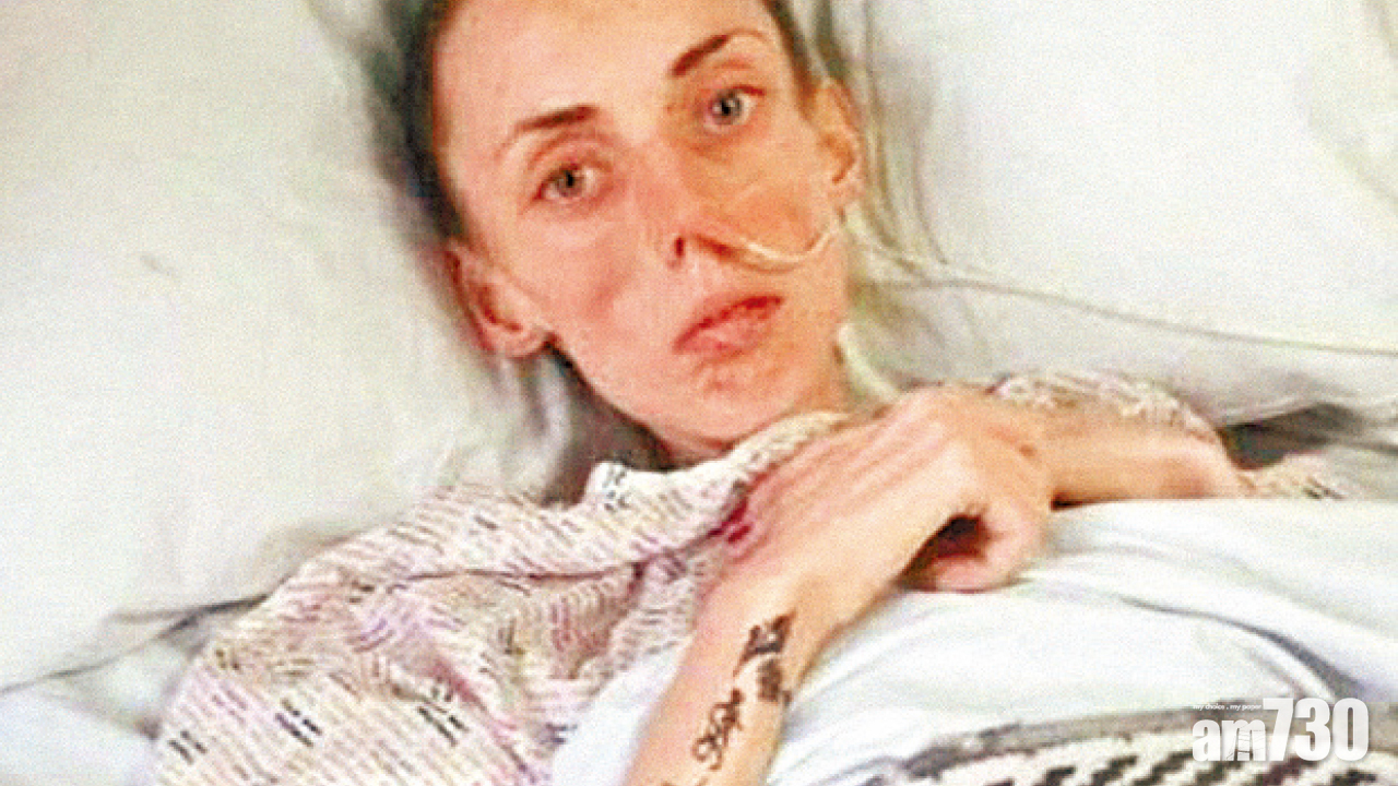 英女受欺凌 厭食慘剩56磅險死