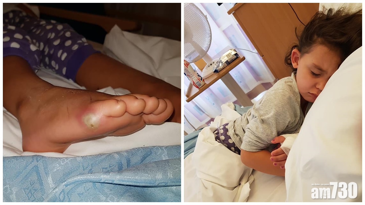 【父母注意】4歲英童試新鞋染敗血症險喪命