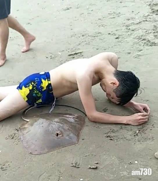男子三亞暢泳 慘遭魔鬼魚刺傷下體