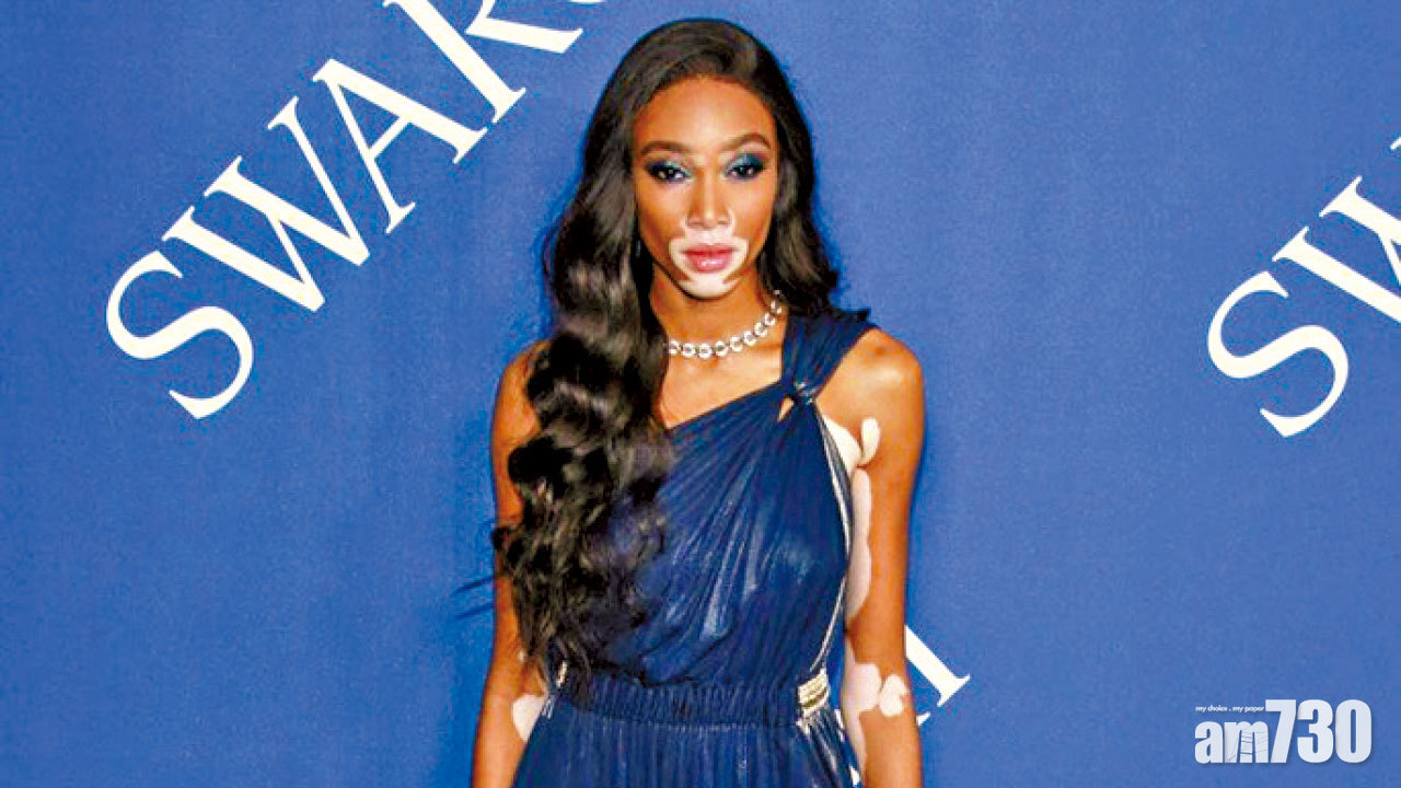 斑臉名模獲邀行VS騷