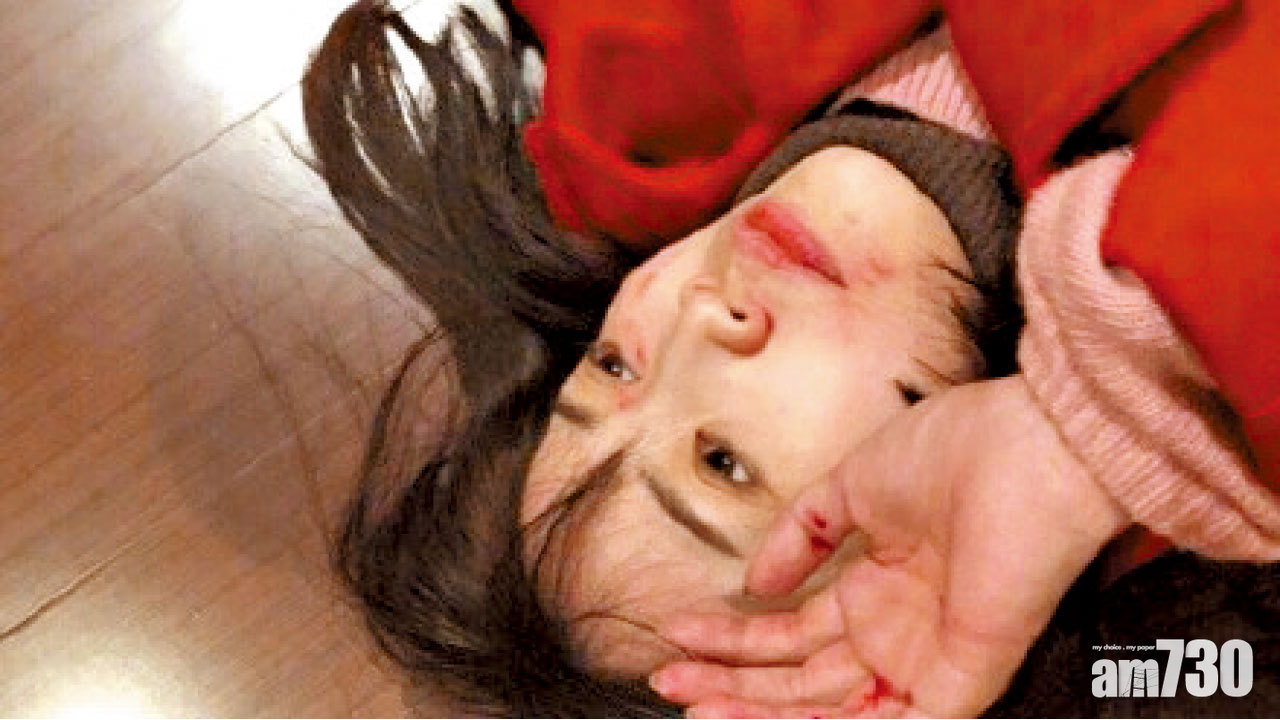 馬蓉控前夫毆打 王寶強律師：有人持剪鬧事