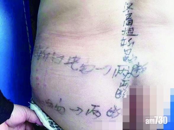 無知大媽生蛇劇痛 寫「符」搵漢高祖「鎮壓」