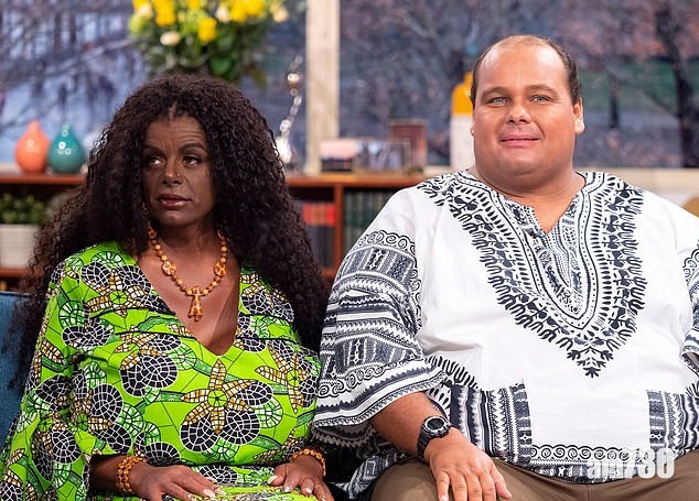 【不是基因決定嗎？】白人夫婦注射激素變黑 稱會產黑人子女