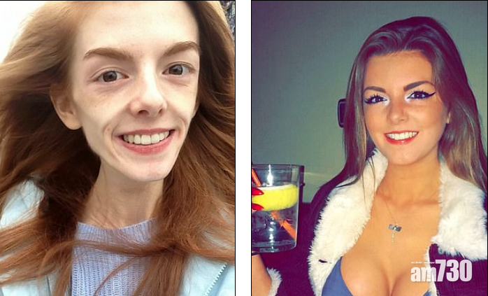 朱古力打救厭食女