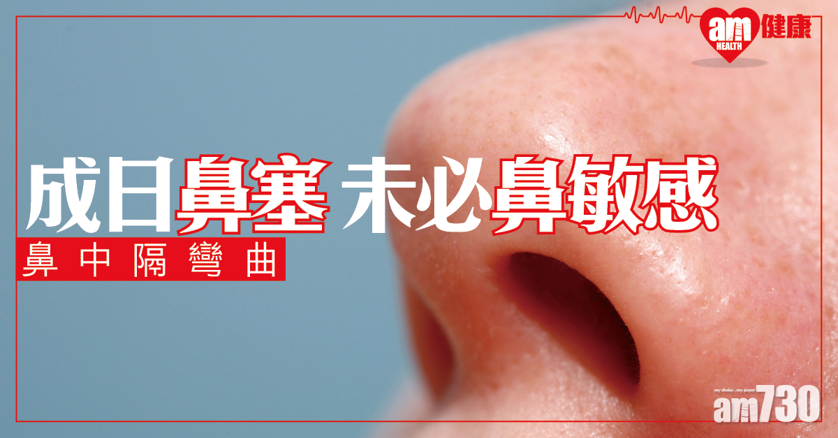 成日鼻塞 未必鼻敏感