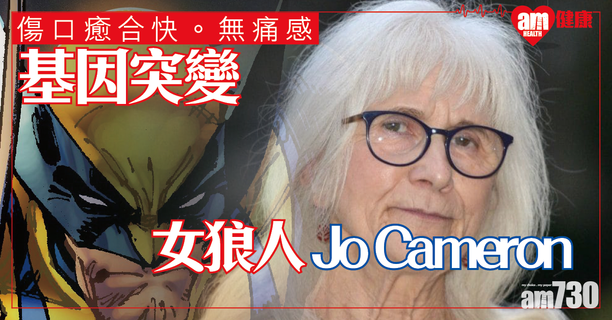 【傷口癒合快‧無痛感】基因突變 現實版「女狼人」