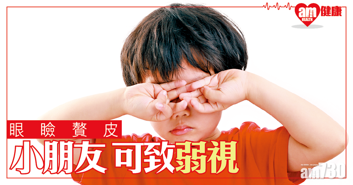 眼瞼贅皮 可致弱視