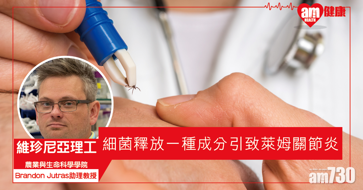 【難纏痛症】研究發現一細胞成分引致萊姆關節炎