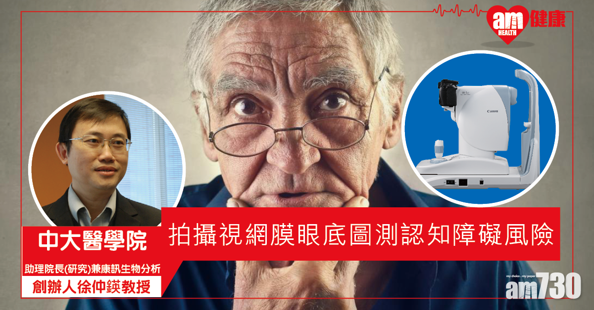 拍攝雙眼測認知障礙症風險