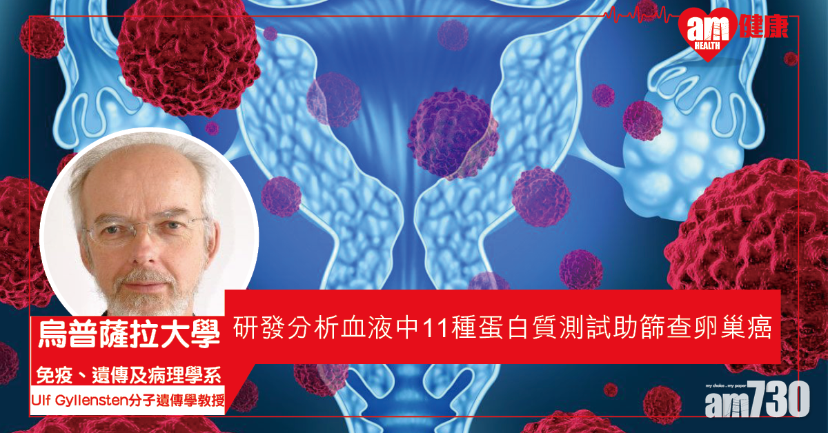 【沉默殺手】瑞典研發生物標記測試 能篩查卵巢癌